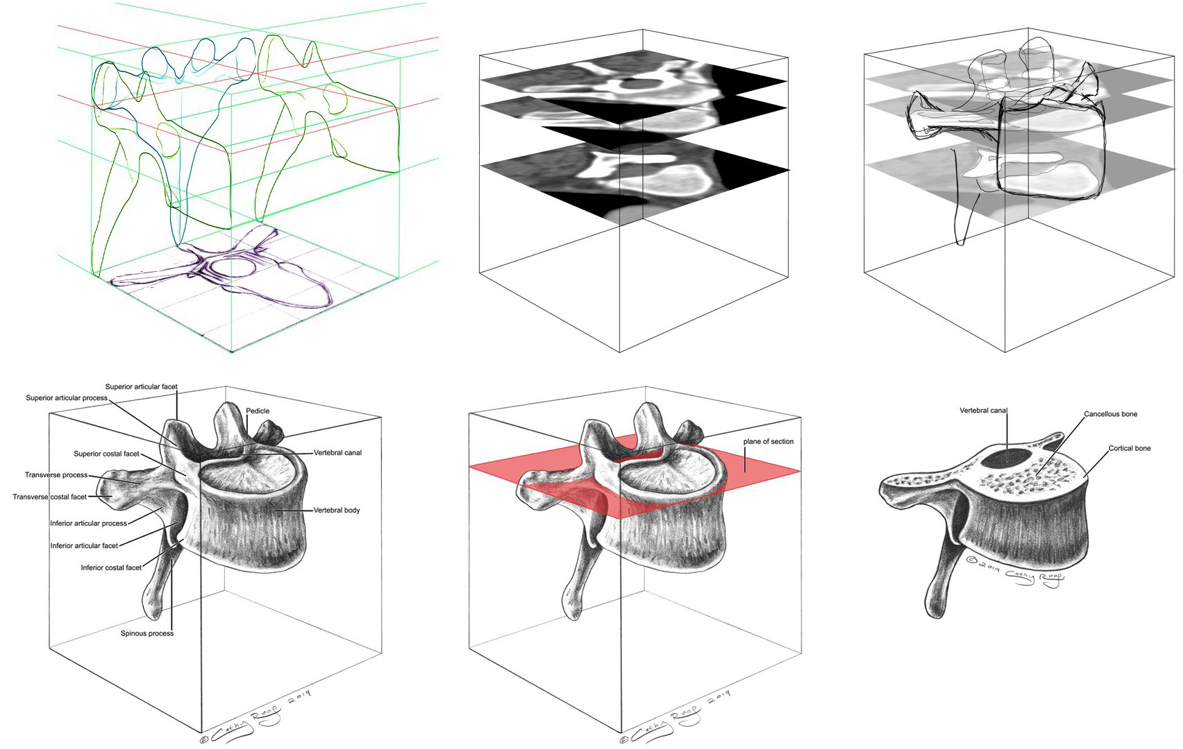 vertebra-in-a-cube-catherine-roop